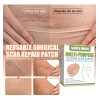 Eliminación Cicatrices Hojas De Silicona Cinta Tiras