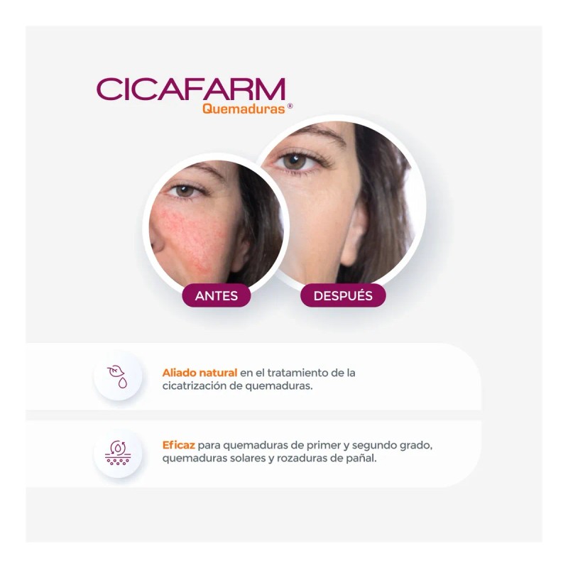 Crema Cicatrizante Quemaduras Superficiales Cicafarm