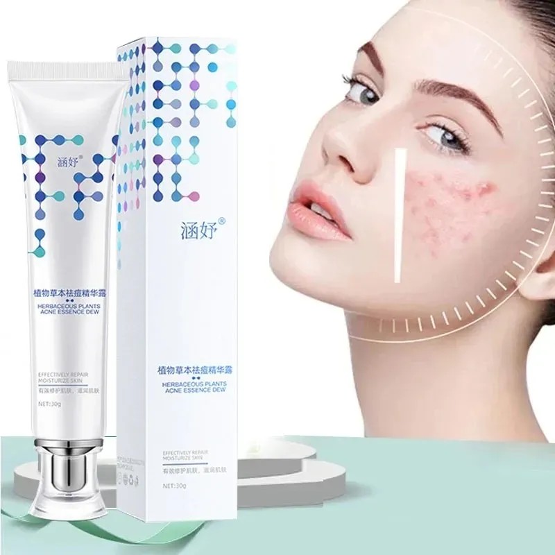 Gel Acné, Antiacné Tratamiento Herbolario Cuidado De La Piel