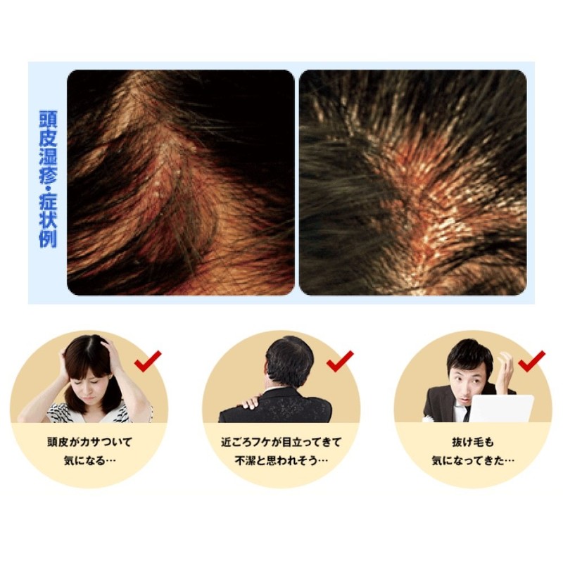 【医薬部外品】メディクイックH ふけ・かゆみを防ぐ 頭皮の環境改善 メディカルシャンプー 200ml
