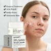2pcs Crema Con Ácido Azelaico Al 20% Niacinamida Y Vitamina