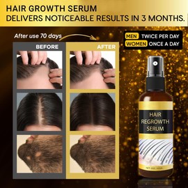 Praiasol Hair Growth Oil Spray: Hair Regrowth Serum with Rosemary Biotin Ginseng for Hair Loss and Thinning-Thicker Fuller Longer - for Women and Men