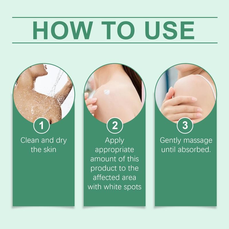 Vitiligo Cream, Natural Effective Vitiligo Treatment for Reduce White Spots