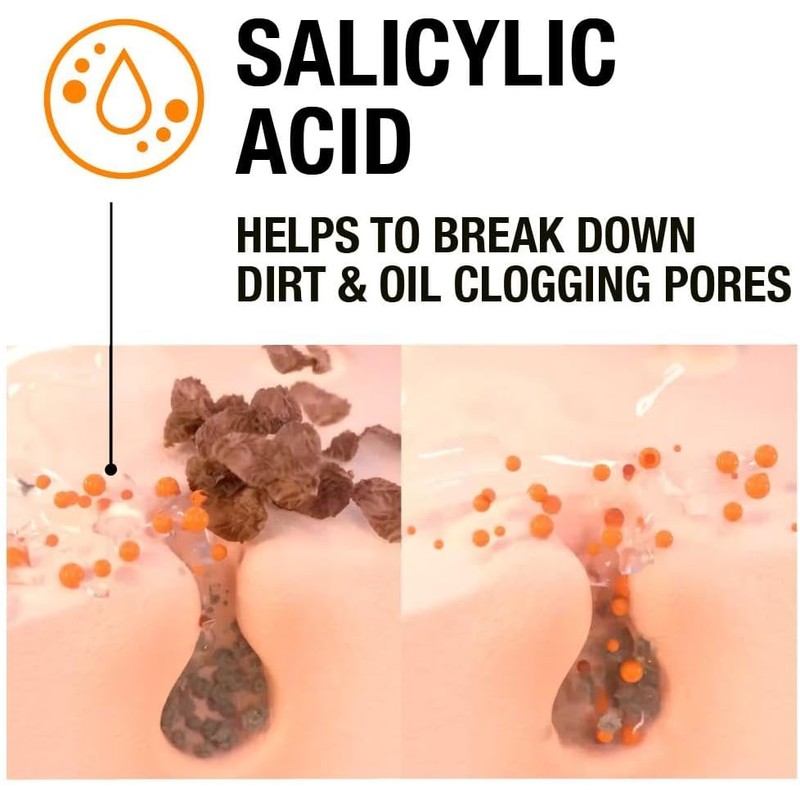 Neutrogena Blackhead Eliminating Facial Scrub 150ml