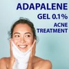 Taro Adapalene 0.1% Acne Treatment Gel - Paraben Free (1.6oz)