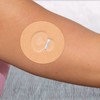 Pflaster Tape Overpatch für Medtronic Guardian Sensor DiaTape Classic myDili