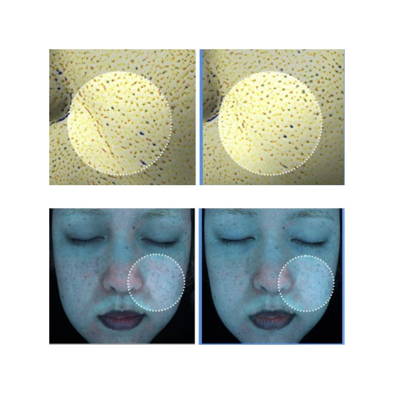 CELL FUSION C Post Alpha Cooling Skin Booster Serum 150ml,