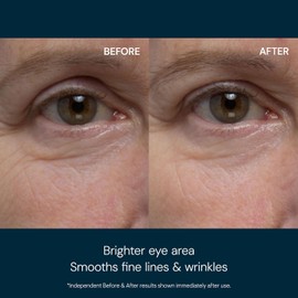 ELEMIS Pro-Collagen Eye Revive Mask – Anti-Wrinkle Multi-Use Eye Treatment for Brightening, Hydration & Youthful-Looking Eyes