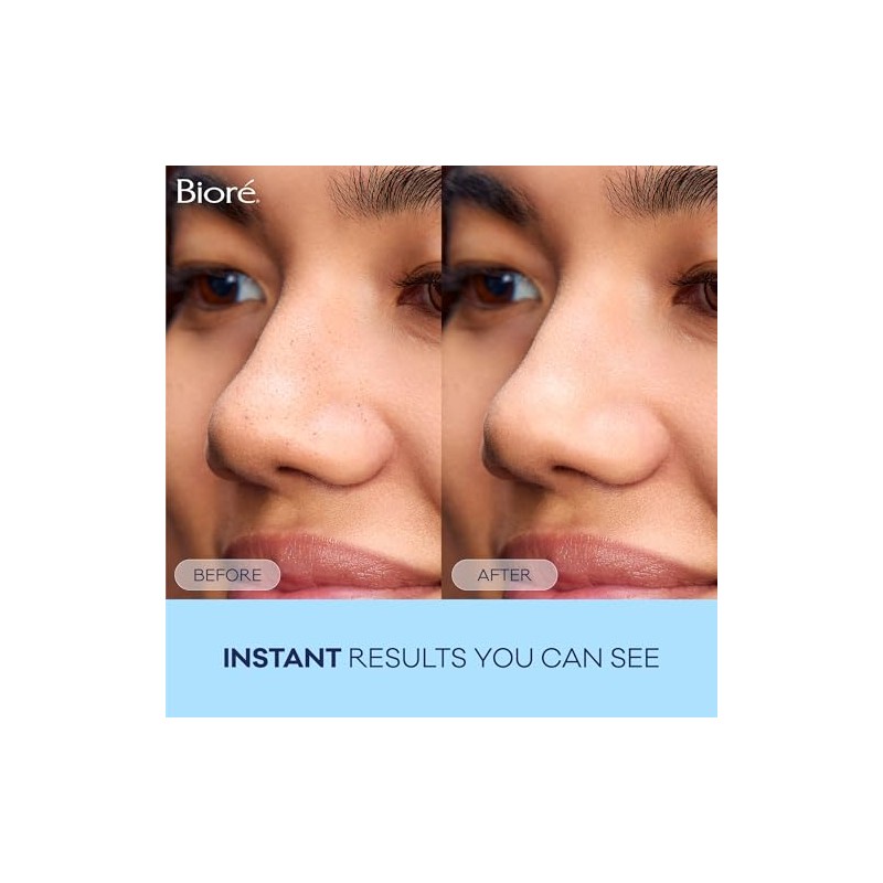 Bior Biore Deep Cleansing Pore Strips For Nose - 14