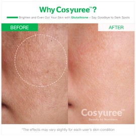 Cosyuree Glutathione Spicule Serum, 120,000 Micro Spicules for Glass Skin, Radiance Booster, Dark Spot, Improve Skin Elasticity & Clarity, Korean Skincare 1.69 fl.oz