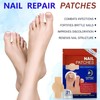 Toenail Care Patches, 21 PCS Overnight Nail Wraps for thick