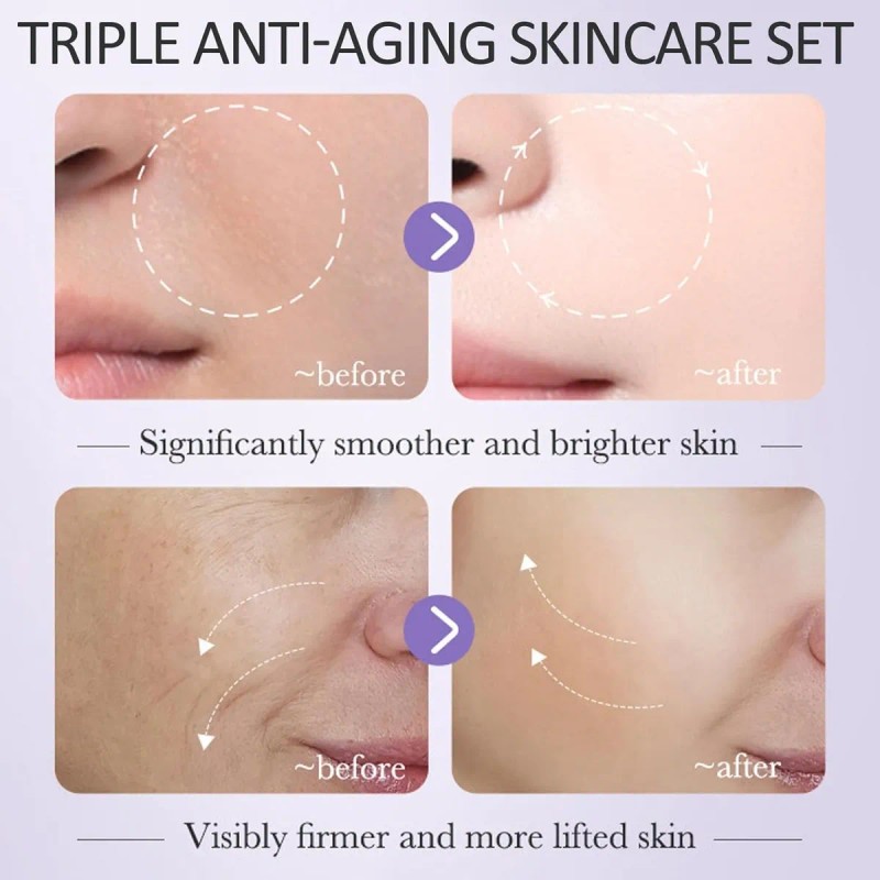 Set Cuidado De La Piel Vitamina C Retinol Y Acido