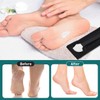 Healifty Pedicure Shaver Foot Corn and Hard Thick Skin Remover