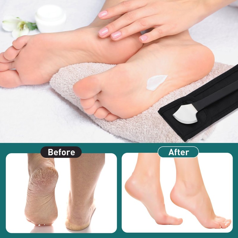 Healifty Pedicure Shaver Foot Corn and Hard Thick Skin Remover