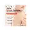 Strawberry® Crema Rejuvenecedora Para Queratosis Pilaris Kp