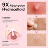 Sosky Invisible Hydrocolloid Acne Patches with Salicylic Acid - 48
