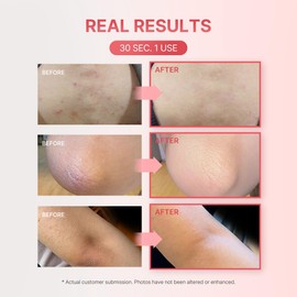 LEPS Flash Reset 29 Peeling Mask Cuticle Care Wash Off PHA16.01% AHA12.6% BHA0.2% LHA0.3% for Face and Body, Korean Skin Care