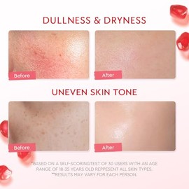 crema facial hidratante e iluminadora con 5% Niacinamide, gel cream con granada para tono desigual y Allantoin para piel sensible, 100 g