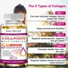 Balincer Collagen Complex Capsules Revitalizes Skin Whitening Antiaging Anti Wrinkles