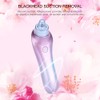 4 Replaceable Heads Blackhead Vacuum Removal Pore Acne Suction Cleanser