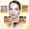 Effective Whitening Freckle Cream Remove Dark Spot Cream Removal Melanin