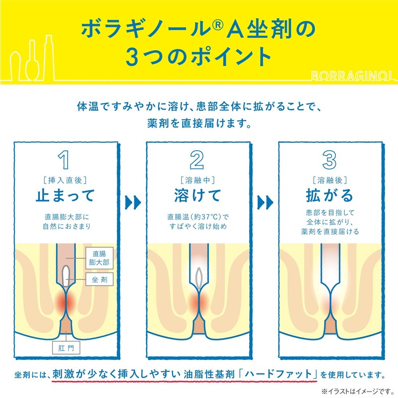 【指定第2類医薬品】ボラギノールA坐剤 10個