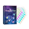 Acne Patch, 180pcs/set Acne Cover Patch, Pimple Patch, Zits Cover
