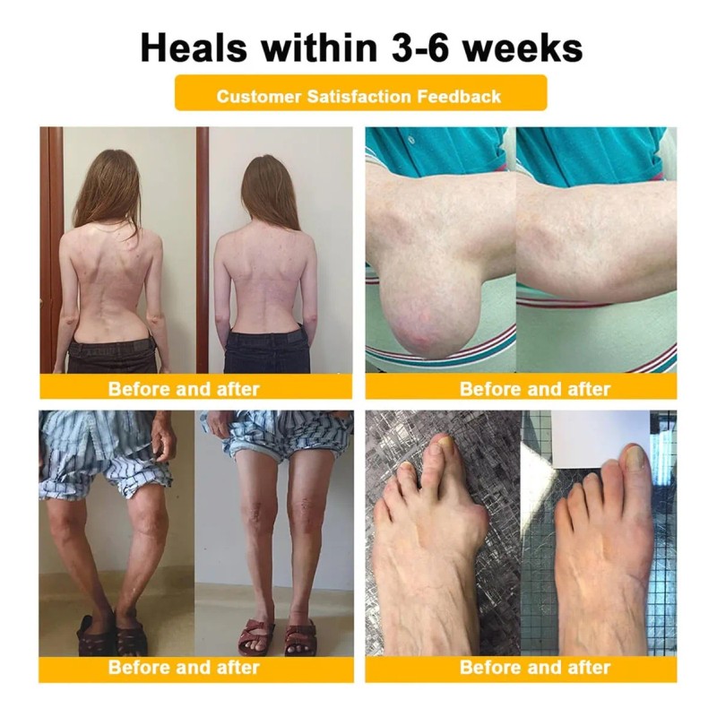 Crema Curativa Crema Botulínica Para Toxinas