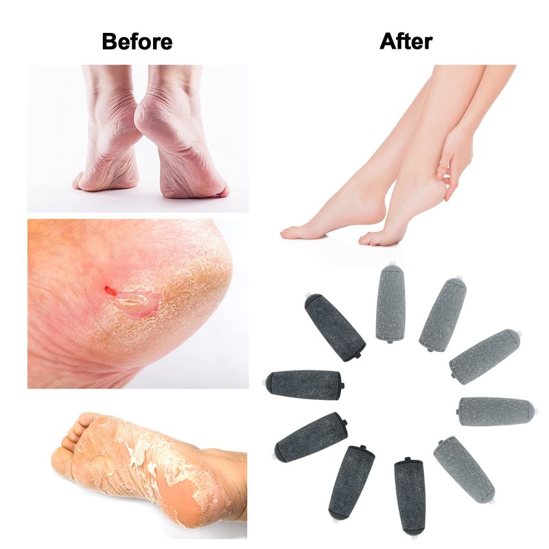 Flawless Pedi Replacement Heads fit for Finishing Touch/Amope Electric Pedicure,