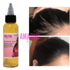7 Day Fast Hair Boom Drops Hair Growth Oil Ginger Growth Hair Treatment Anti Hair Loss Men Women Scalp Treatment Serum Products Beauty Product