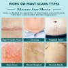 Silicone Scar Sheets,(1.6" X 120" Roll- 3M)Silicone Scar Tape for