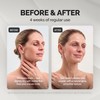 GESS Exotic Ultrasonic Face Lifting Device - Gentle Exfoliation, Skin