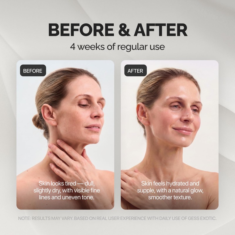 GESS Exotic Ultrasonic Face Lifting Device - Gentle Exfoliation, Skin
