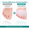 Silicone Toe Separator Forefoot Pad for Daily Comfort – Five-Hole