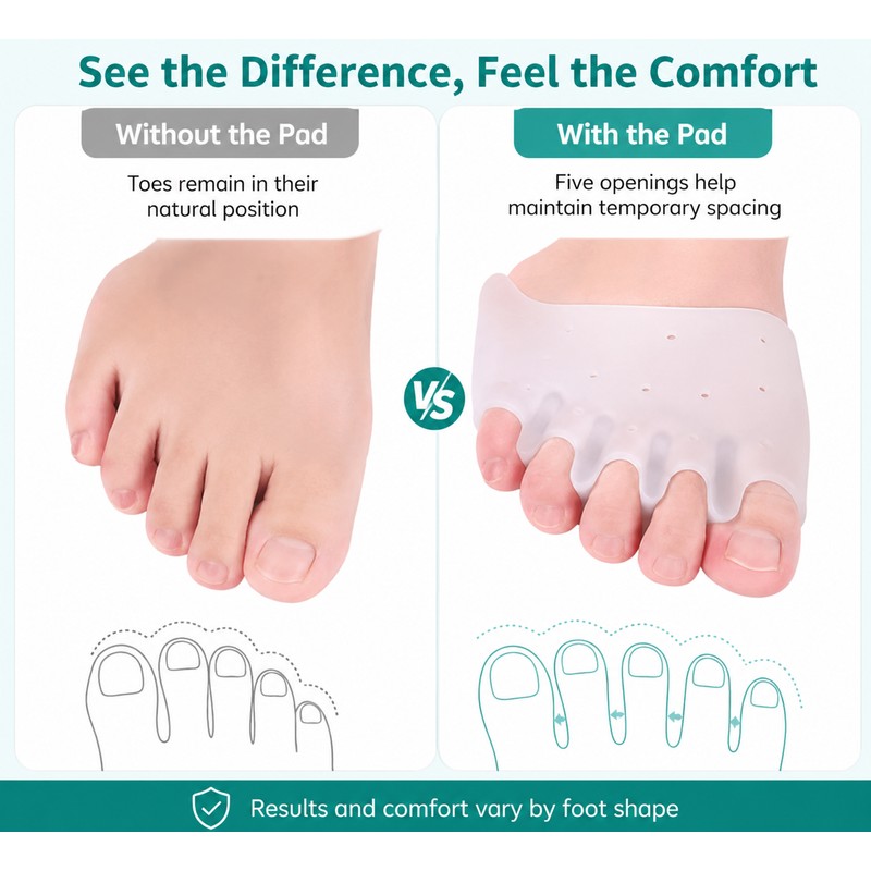 Silicone Toe Separator Forefoot Pad for Daily Comfort – Five-Hole