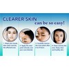 CLERZENA Clear Pimple Patches for Face - Hydrocolloid Acne Patches