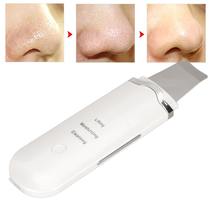 Electric Skin Scrubber Pore Spatula Face Cleaning Blackhead Removal Ultrasound