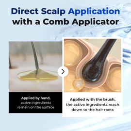 EPAIS Scalp Boosting Serum, Comb Applicator Scalp Ampoule with 38 Brush Tips, Clinically Tested Dandruff & Flake Reduction, Biome PDRN Exosome, Korean Hair Care, 5.07 fl.oz.
