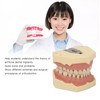 Dental Teaching Model Soft Gum 32 Teeth Dental Demonstration Teeth