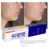 ANTI- ACNÉ Anti Acne Crema Cicatrices Cacarizos Grasa Tratamiento Piel