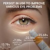 Vitamin C Eye Roller Serum for Dark Circles & Puffiness,Eye