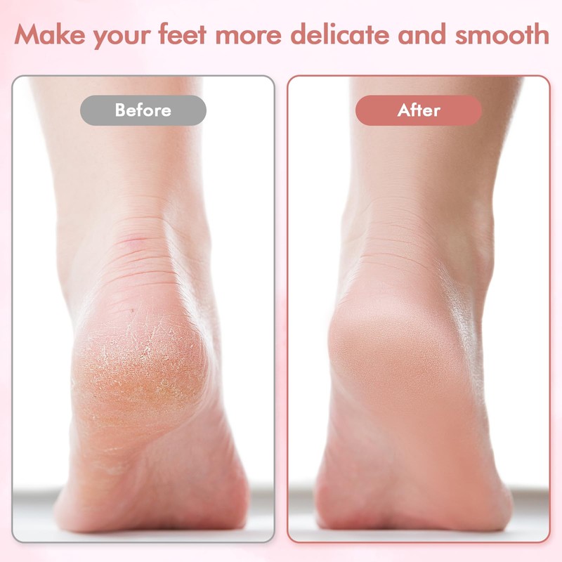 Electric Foot File and Callus Remover,Professional Pedicure Tools for Dry,