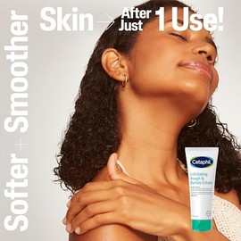 Cetaphil Crema áspera y con baches, 20% urea, exfolia suavemente, 8 onzas