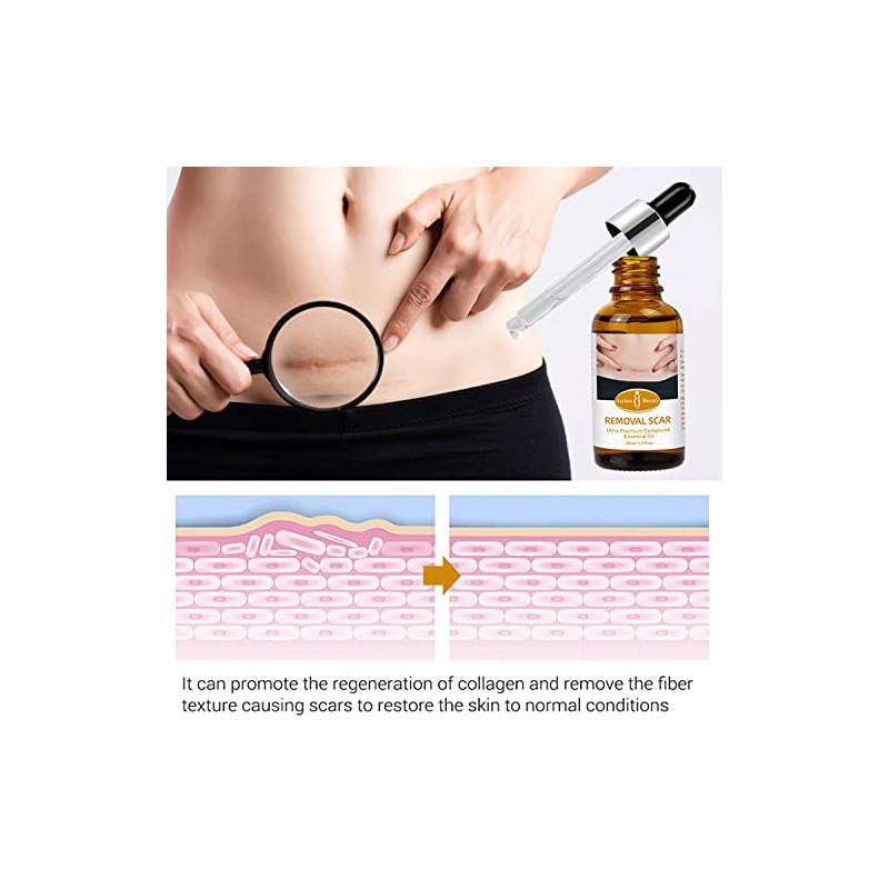 Aichun Beauty Células de reparación de aceite esencial compuesto premium