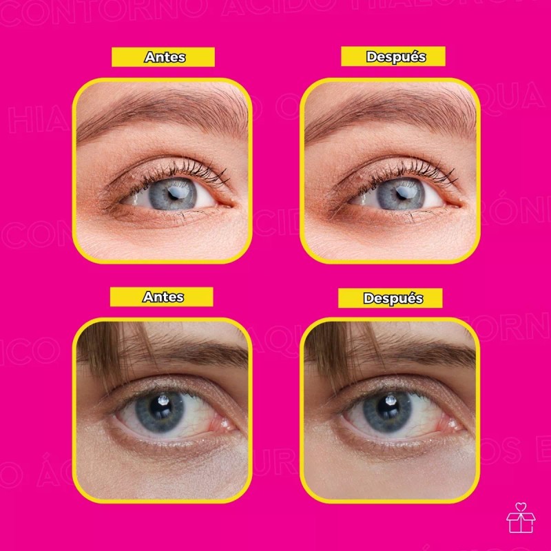Rorec Crema Para Contorno De Ojos De Ácido Hialuronico Anti