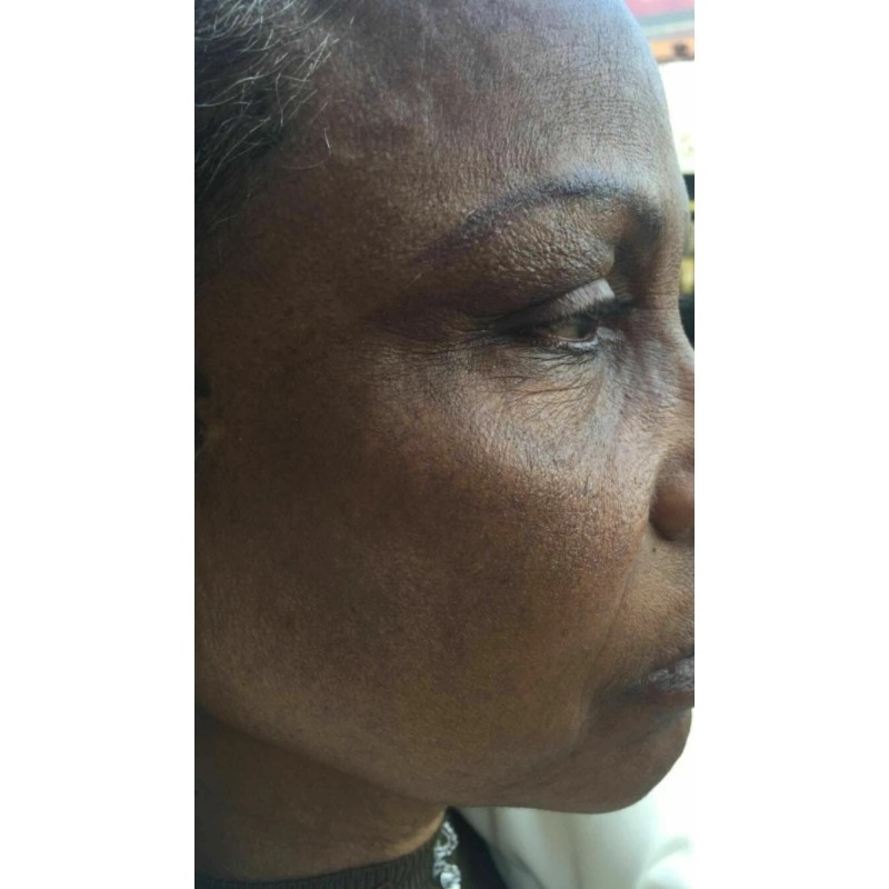 Crema aclaradora White Fade Super Skin, Para Piel Triguena O