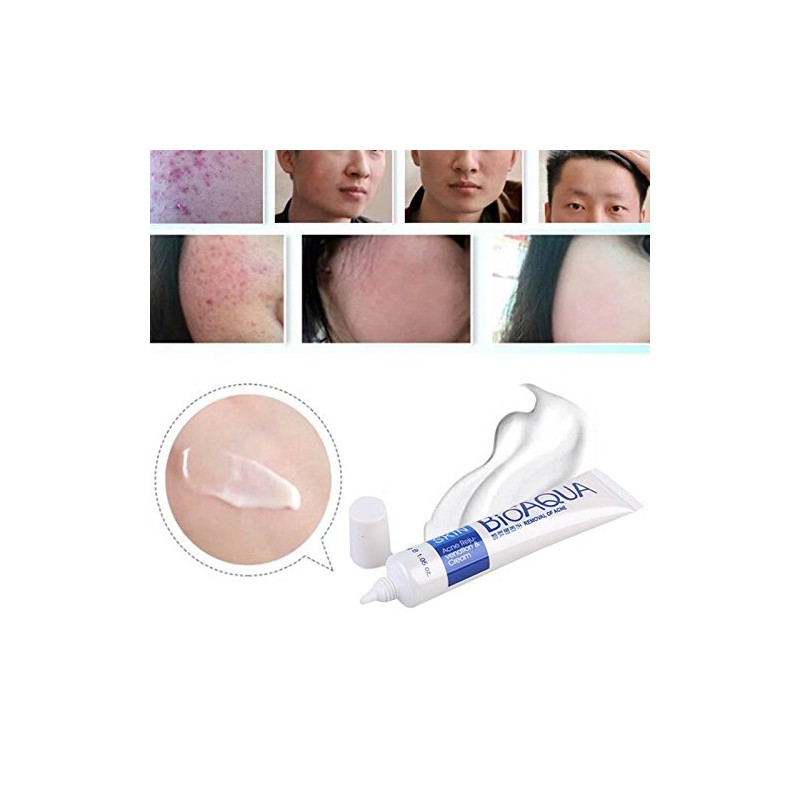 Bioaqua Acne Cream Cicatrices Poros Control De Grasa 1 Pzs