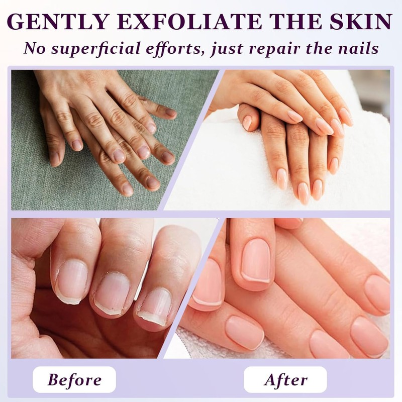 Nail Exfoliating Pen
