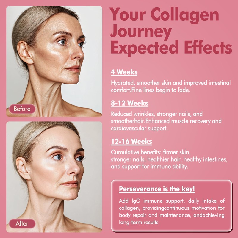 KEDISOM Bovine Colostrum with Collagen Peptides Powder for Gut Health,