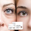 Eliminador De Oscuridad Para Hiperpigmentación Facial, Melas